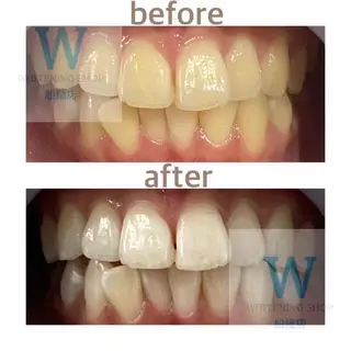 ホワイトニング ショップ船橋店🦷のエステ・リラクイメージ