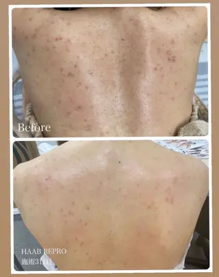 トータルビューティ サロンstageのエステ・リラクイメージ