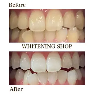 ホワイトニング ショップ津店のその他イメージ