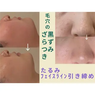 swan(スワン) 韓国肌管理 南堀江のエステ・リラクイメージ