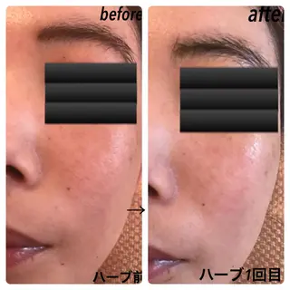 fairyrose organicエステのエステ・リラクイメージ