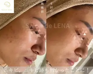 ハーブピーリング専門 グランディール　武内のエステ・リラクイメージ