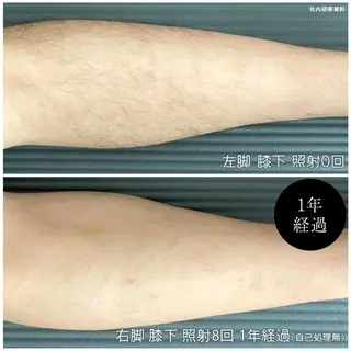 メンズ 痩身・脱毛・美髪ケア 【GLYCINE】のエステ・リラクイメージ