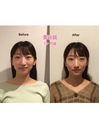 チキバン美容鍼灸整体 サロン心斎橋店のエステ・リラクイメージ