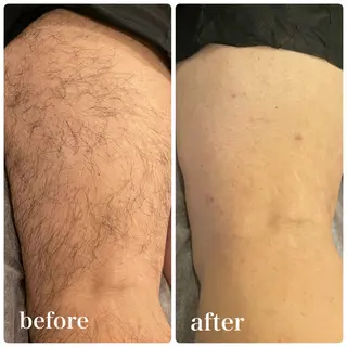 脱毛専門サロンElixir加須店所属・脱毛専門サロン Elixir　加須店のエステ・リラクイメージ