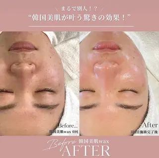 Lattina beautysalon所属・Lattina ラティーナのエステ・リラクイメージ