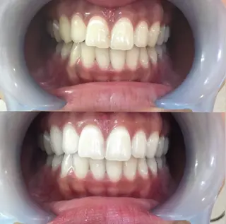 LOVE ホワイトニング戸辺のその他イメージ