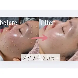 肌管理専門店 Santevistaのエステ・リラクイメージ