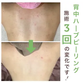 エステサロン JURISのエステ・リラクイメージ