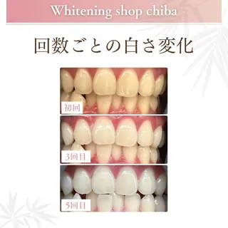 メンズ ホワイトニング ショップ千葉店のエステ・リラクイメージ