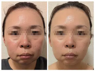 美肌と小顔のサロン RUVIAのエステ・リラクイメージ