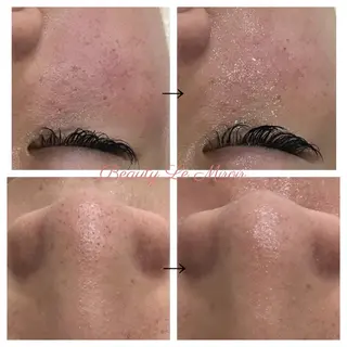 ビューティー ミロワールのエステ・リラクイメージ