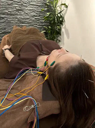小顔矯/美容鍼/鍼灸 BeauJuのその他イメージ