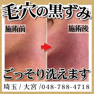 脱毛 TOWA大宮のエステ・リラクイメージ