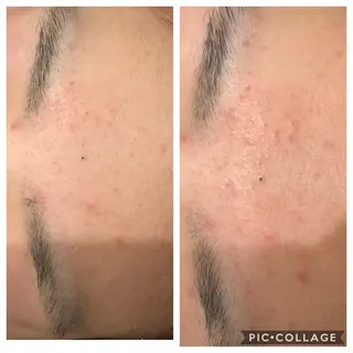 セミロング カラー パーマ ヘアアレンジ メンズ キッズ ネイル マツエク・マツパ 金の糸脱毛 産毛ケア専門のエステ・リラクイメージ