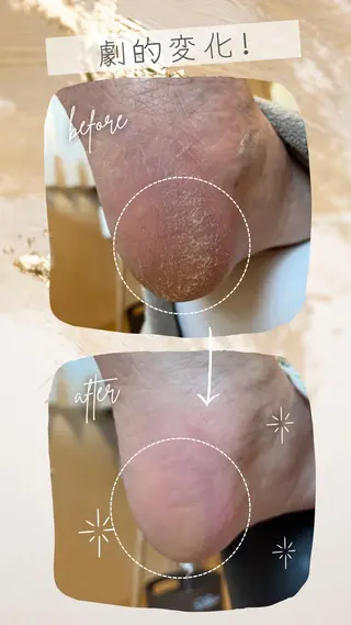 ネイル Nail care PONOのネイルデザイン