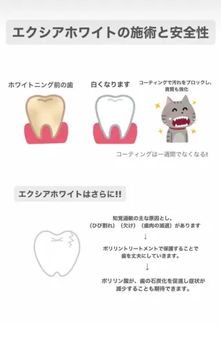 ecxia  white 　広島袋町店所属・セルフホワイトニング エクシア広島袋町店のその他イメージ