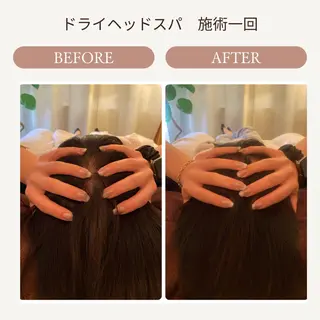 ハーブピーリング🌿 脱毛🧡ヘッドスパのエステ・リラクイメージ