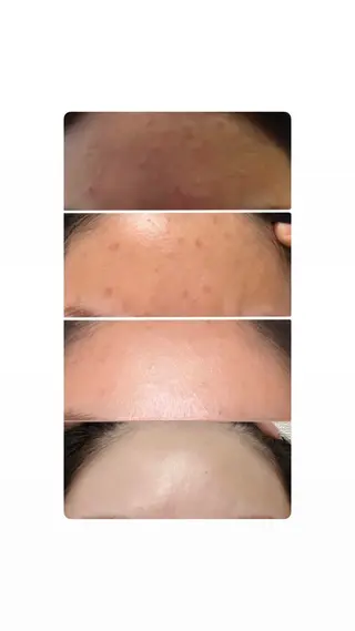 blossom沖縄所属・la salon. chihoriのエステ・リラクイメージ