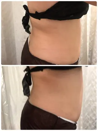 Aloha Mana 草加Ohana店のエステ・リラクイメージ