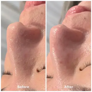 ✨韓国肌管理✨ Lisaのエステ・リラクイメージ