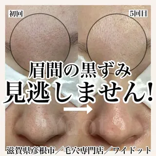 Ydot. 池内 友架のエステ・リラクイメージ