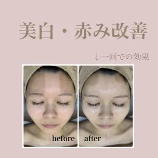 🤍Linola🤍 レイビス 須藤のエステ・リラクイメージ