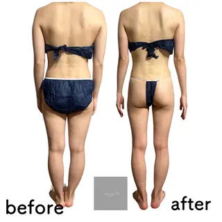 marron所属・痩身ハイパーナイフ ララピールリアボーテのエステ・リラクイメージ