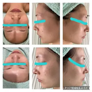 脱毛サロン ミュー松山本店のエステ・リラクイメージ