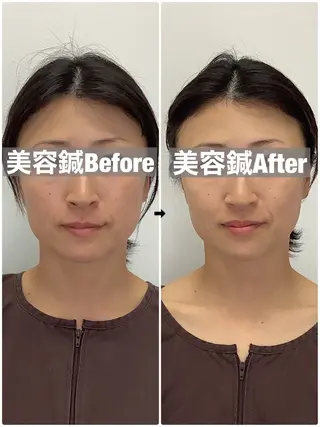 ハリサロンドオフ 美容鍼灸×小顔整体のエステ・リラクイメージ