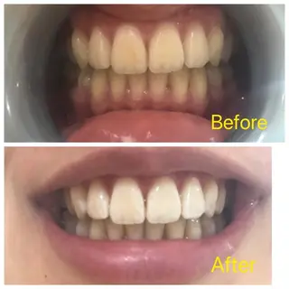 M渋谷 ホワイトニングのエステ・リラクイメージ