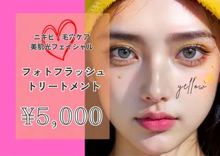 yellow💛【 脱毛&フェイシャル】のエステ・リラクイメージ