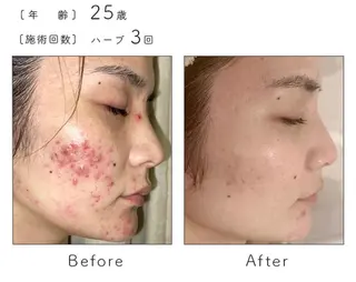 SALON BioBioのエステ・リラクイメージ