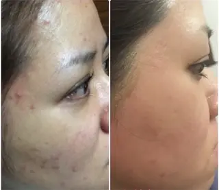 Beauty salonBellのエステ・リラクイメージ