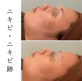 ハーブピーリング専門 BIOPLUS+川崎のエステ・リラクイメージ
