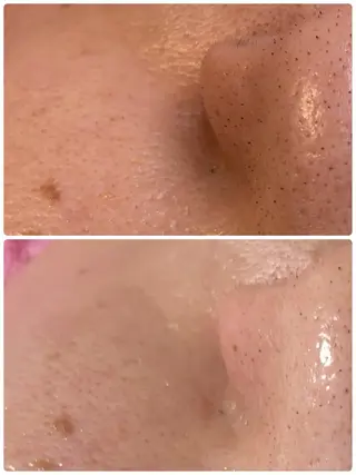 プライベートサロン エクスティアラのエステ・リラクイメージ