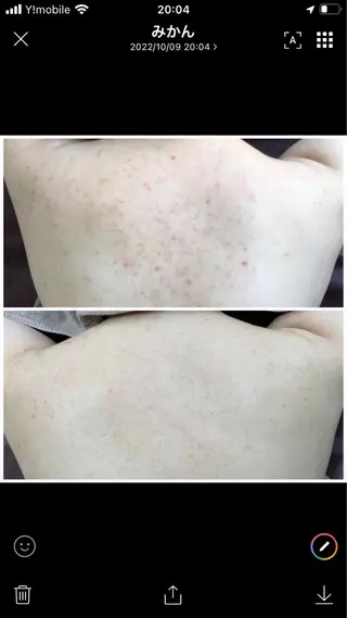 ショート カラー パーマ ヘアアレンジ メンズ キッズ ネイル マツエク・マツパ アイブロウ ハーブピーリング専門 🌿モッカのエステ・リラクイメージ