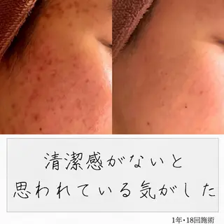 ニキビ経験者が施術 する専門サロン🌻のエステ・リラクイメージ