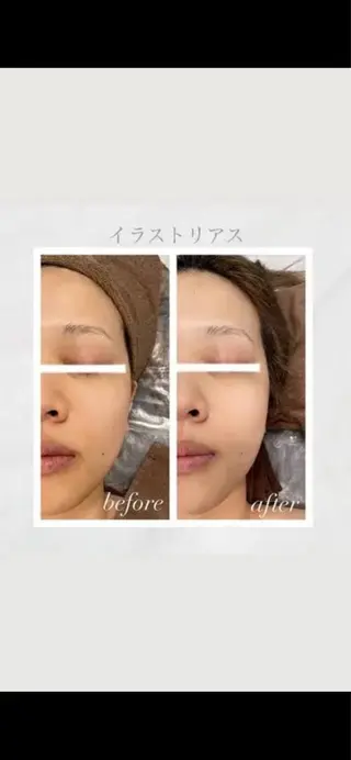 ハーブピーリング専門 BIOPLUS+川崎のエステ・リラクイメージ