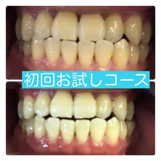 ホワイトニングルーム 横浜店のその他イメージ