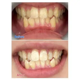 Ｍ渋谷 ホワイトニングのエステ・リラクイメージ