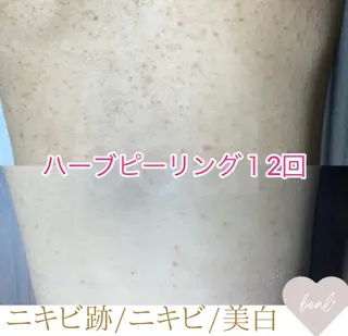 小顔/毛穴/ニキビ salon bealのエステ・リラクイメージ