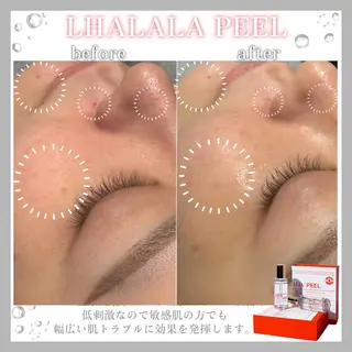 肌質改善サロン Meilily🦋のエステ・リラクイメージ