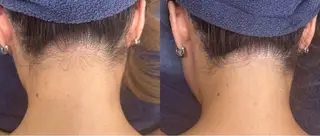 Le cherienのエステ・リラクイメージ