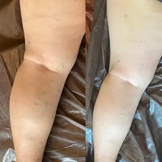 メンズ ネイル AKALA エステ リンパマッサージのエステ・リラクイメージ