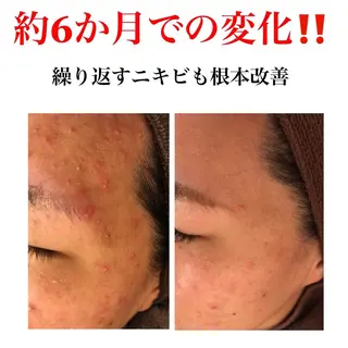 ミディアム カラー パーマ ヘアアレンジ メンズ キッズ ネイル マツエク・マツパ ニキビ・肌質改善専門 ♡人生が変わるサロンのエステ・リラクイメージ