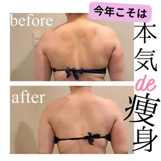 小顔・リフトアップ/ 奈緒美のエステ・リラクイメージ