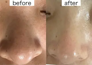 医療提携Beauty SalonMuseのエステ・リラクイメージ