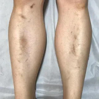 Lilyboo 星のエステ・リラクイメージ