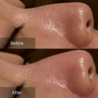 for woman所属・森 美優のエステ・リラクイメージ